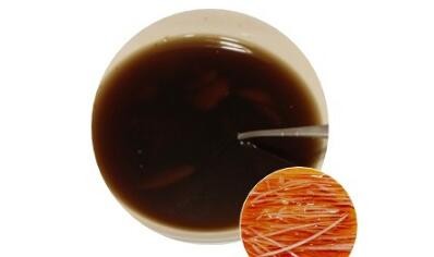 可乐生姜水的功效