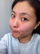 皮肤的基本小知识