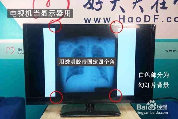 如何用手机拍照医院检查的影像片子