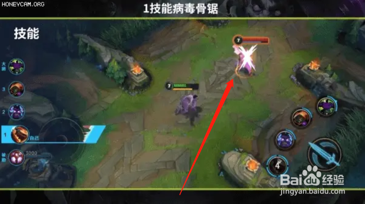 英雄联盟蒙多重做技能介绍