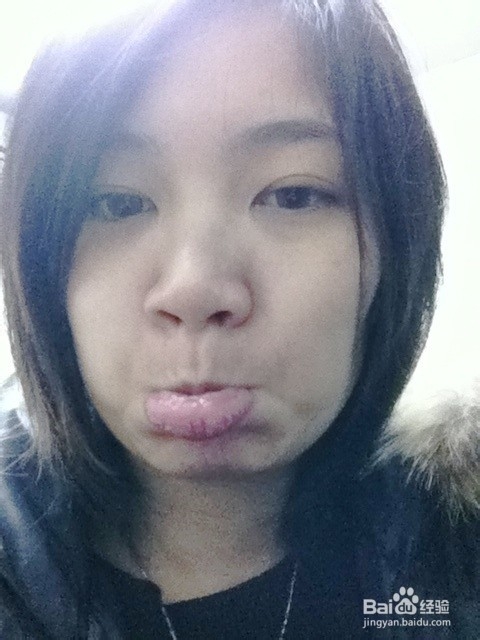 维生素B族的缺乏身体会有那些症状呢