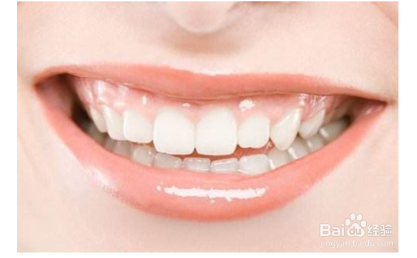 两颗门牙外凸,拍婚纱照怎么办