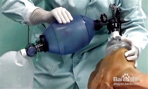 简易呼吸器如何使用