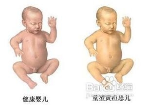 宝宝出生后一