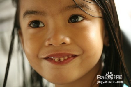 家长如何判断小朋友有无蛀牙?