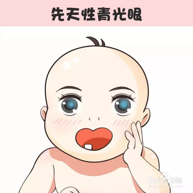 婴幼儿型青光眼图片