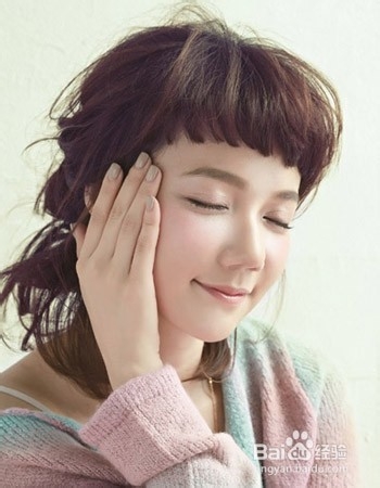 脂溢性皮炎治疗方法分享