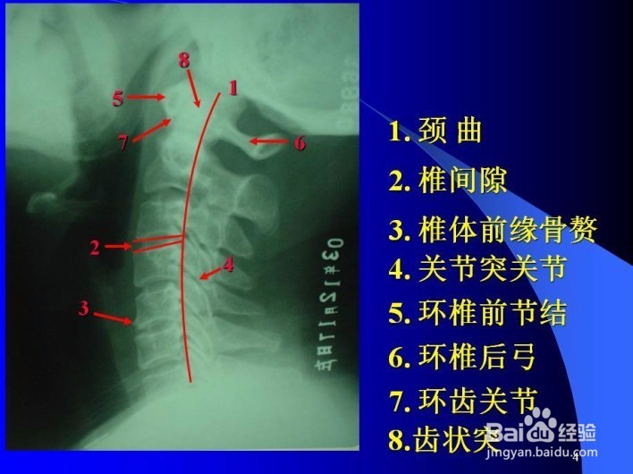 脊椎病的诊断与观片方法