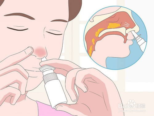 如何消除鼻塞