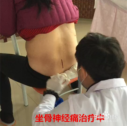 刺血的理论依据及基本原则