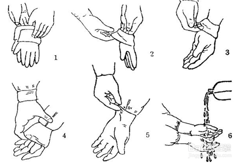 医用手套的正确戴法图片
