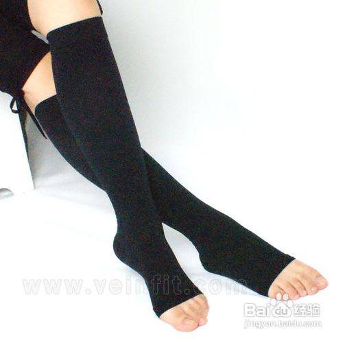 静脉曲张怎么治？