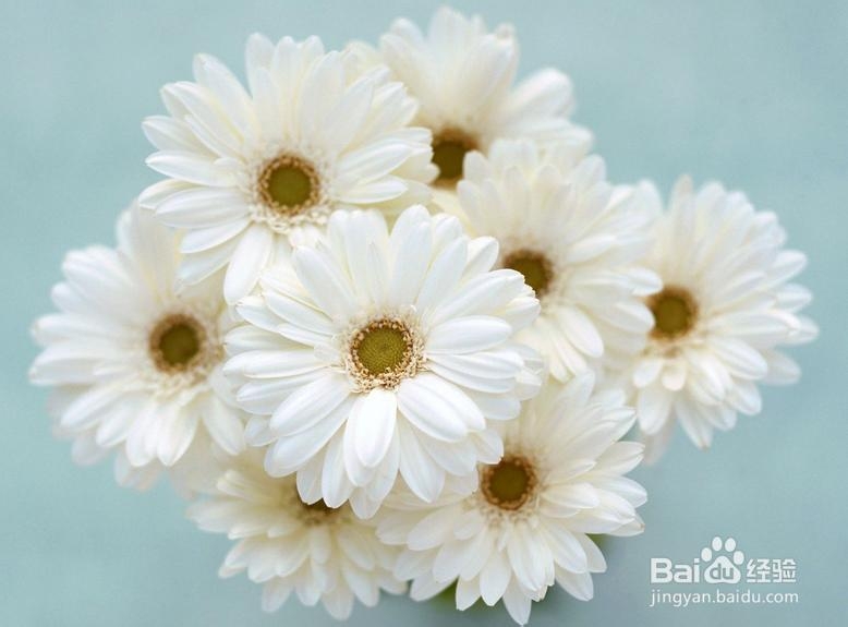 诊断偏头痛应该做哪些检查