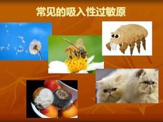 怎么查过敏源