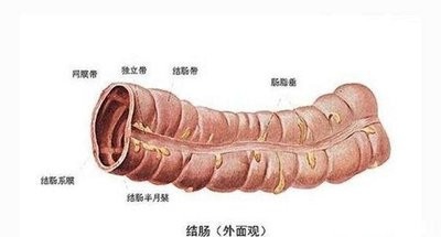 结肠炎的症状及治疗