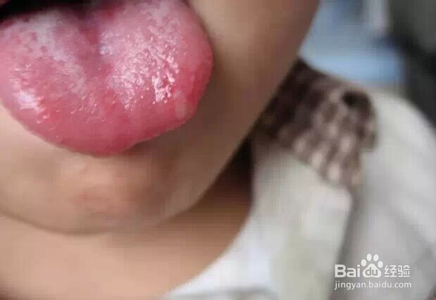 手足口病高峰期将到，6招教宝宝远离病毒