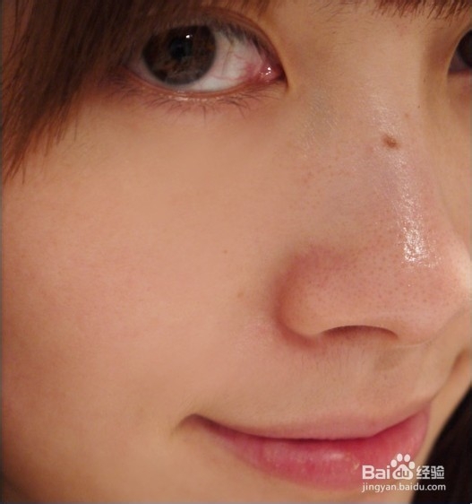 尽早摆脱“草莓鼻”，妮儿给i来支招！！！