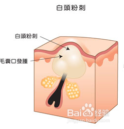 日常肌肤护理：[1]洗脸篇