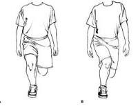 椭圆机怎么练不伤膝盖