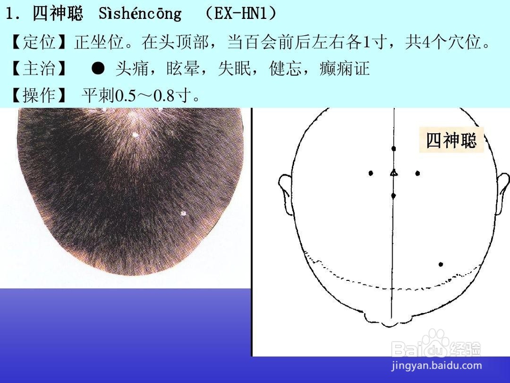 保健大脑——四神聪