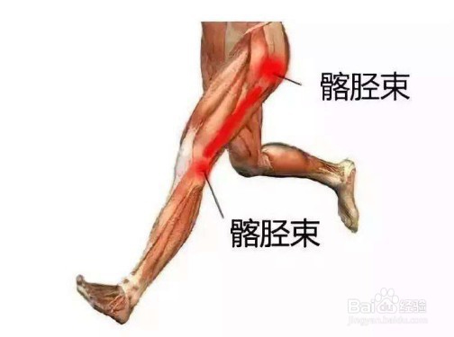 跑步膝盖疼的恢复方法有哪几类?