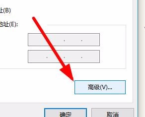 win10怎么进入tcp/ip高级设置