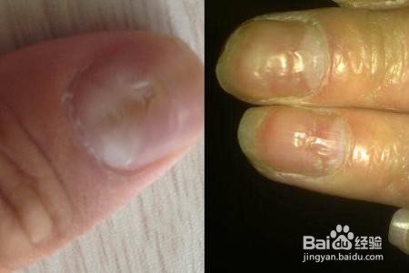 涂指甲油的危害！