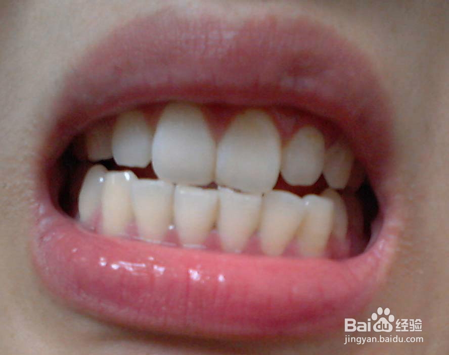 没有牙签，怎样把牙缝里的菜弄出来