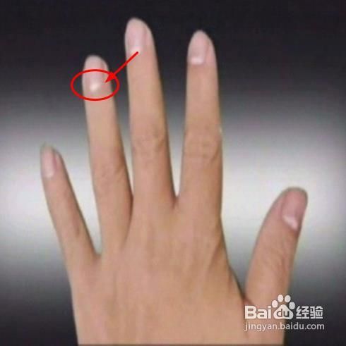 观半月痕的颜色晓健康