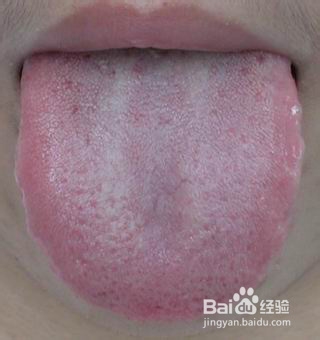 观舌苔辨病症