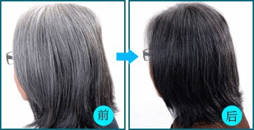 白发怎么预防?白发与身体关系是怎样的