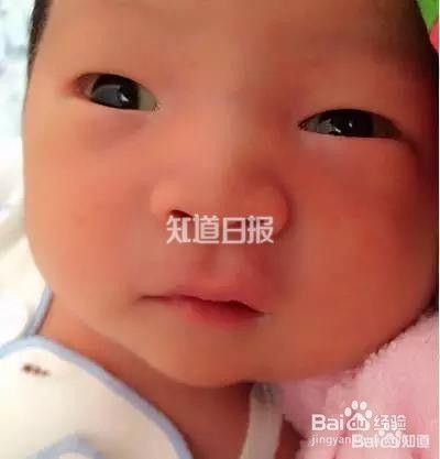 眼白出现这几种颜色 你该警惕了 百度经验