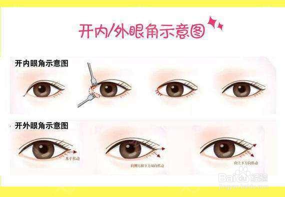 开眼角值得做吗？