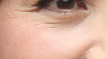 PS如何去除皱纹