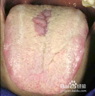 原来身体也有密码：[3]舌头告诉你的6个密码