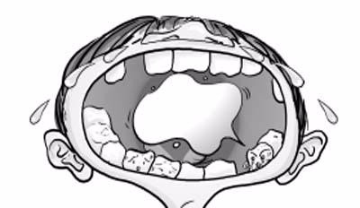 根治牙痛的方法