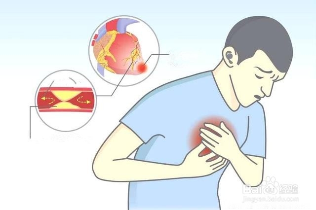 不痛不痒，查出肺癌，肺癌查出之前有哪些症状？