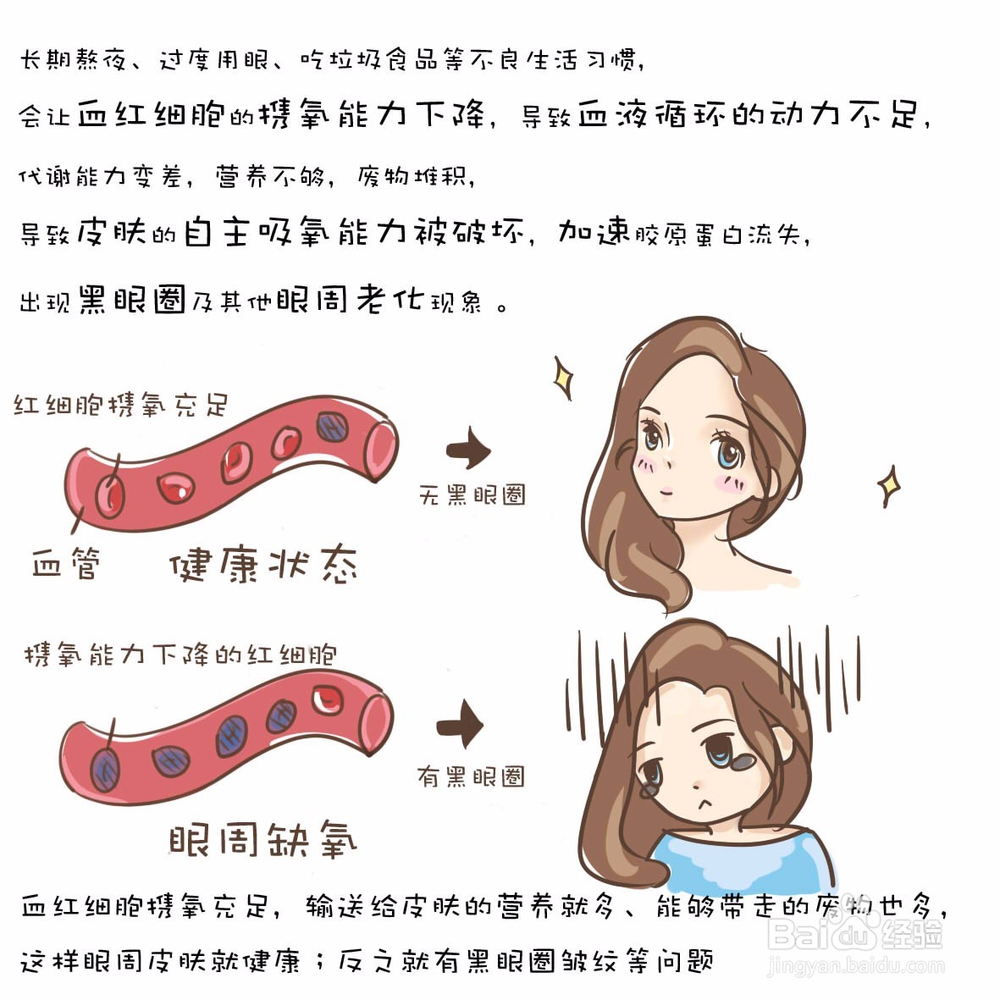 黑眼圈护理小知识