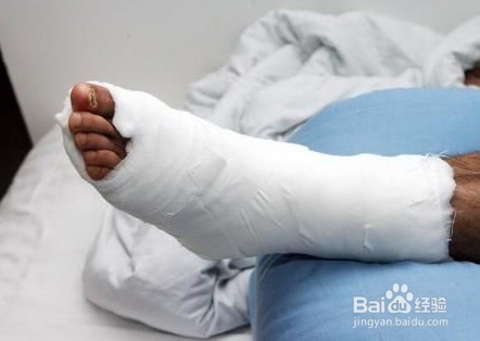 治疗老烂腿的方法