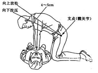 急症处理系列经验：[3]过敏
