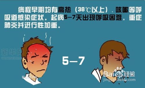 h7n9禽流感预防知识大全