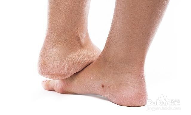 如何防止起皮？