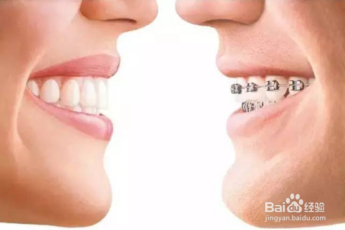 矫正牙齿的错误认识