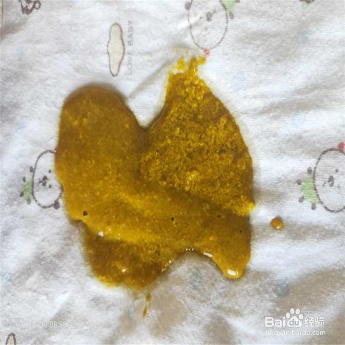 怎样照顾刚出生的宝宝
