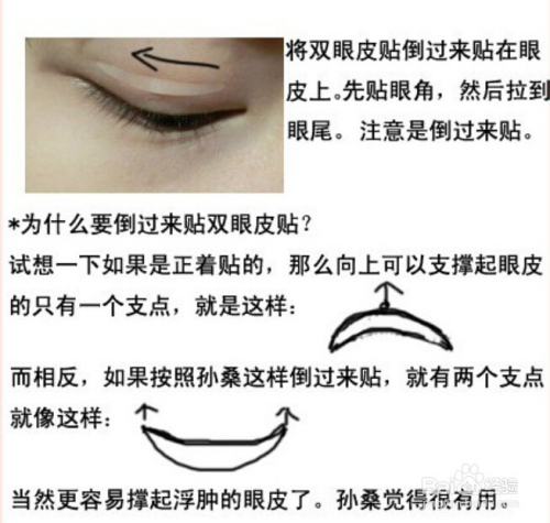 孙桑桑的双眼皮倒贴法