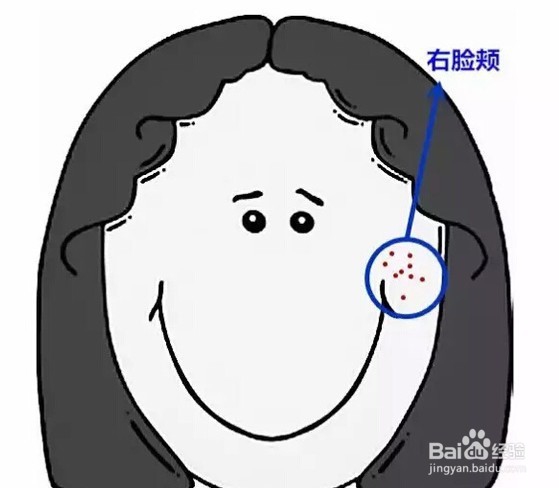 祛痘的图解,祛痘要坚持