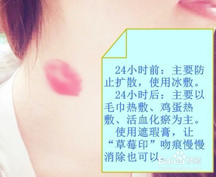 怎么消除草莓印吻痕