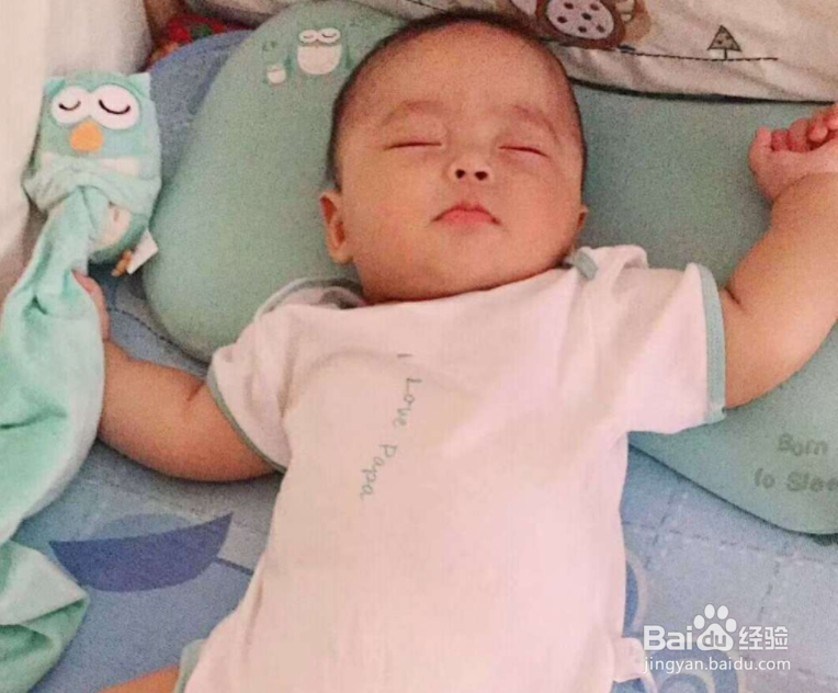 夏季宝宝的痱子反复发作,怎么办
