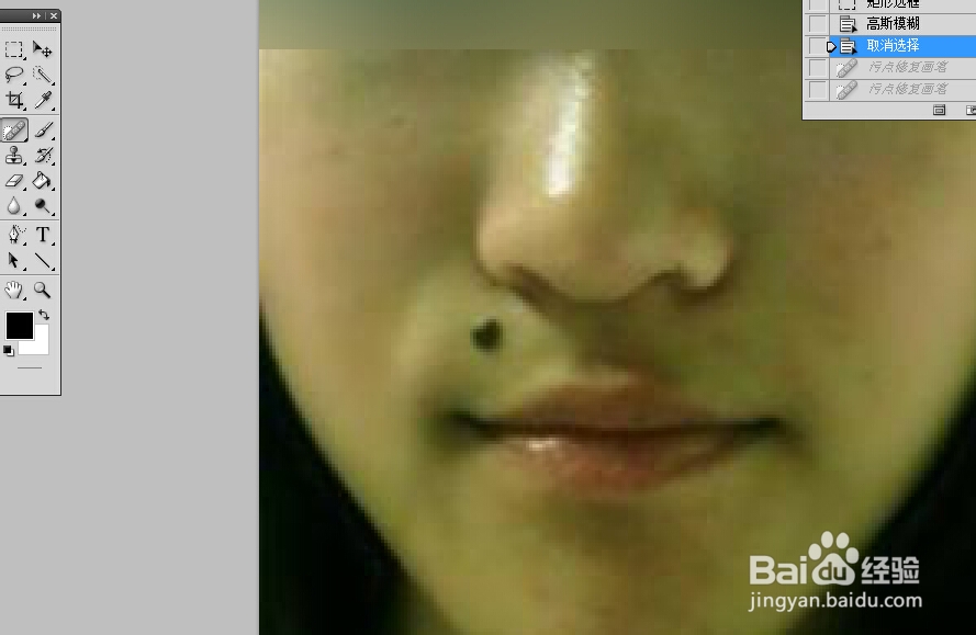 如何用PS去掉照片脸上的痦子