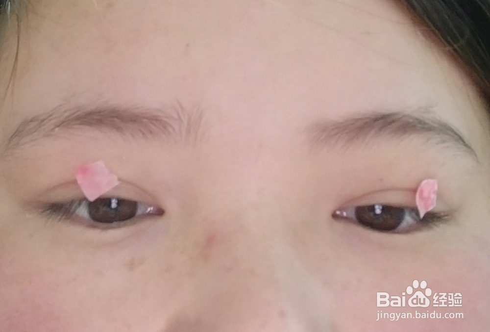 眼皮老跳怎么办